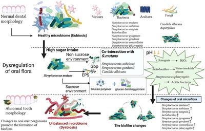 Association of polymicrobial interactions with dental caries development and prevention